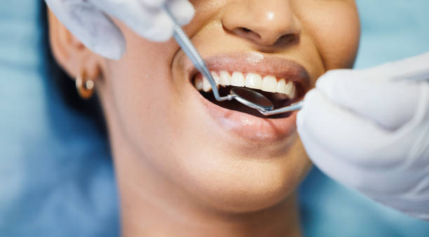 Best Emergency Denture Repair in St Louis Park, MN